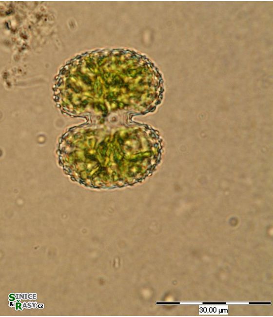 Cosmarium portianum