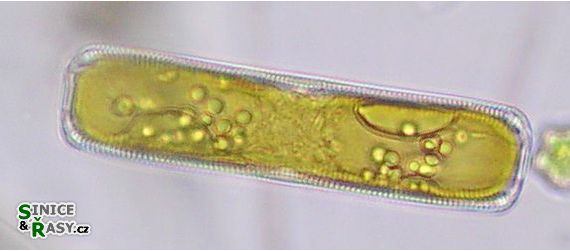 Pinnularia