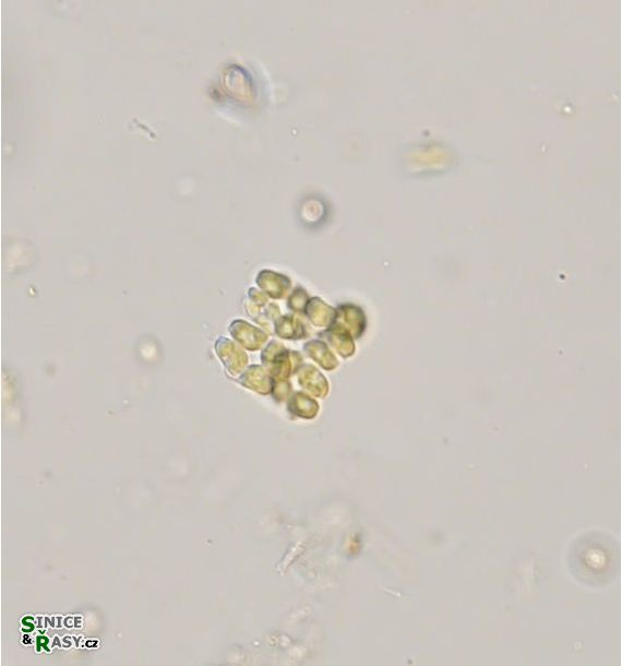 Crucigeniella apiculata