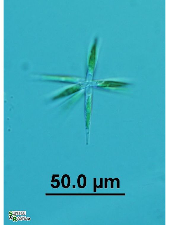 Actinastrum hantzschii
