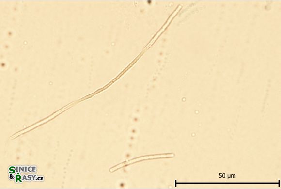 Leptolyngbya