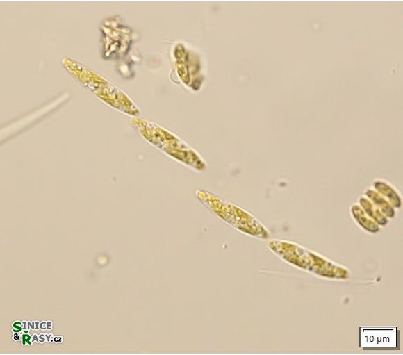Elakatothrix genevensis