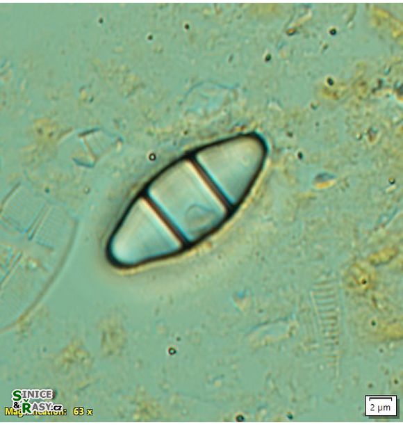 Odontidium mesodon