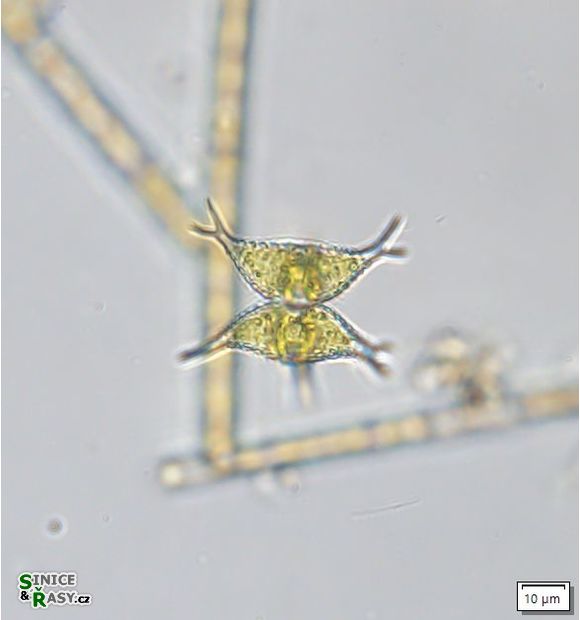 Staurastrum subcruciatum