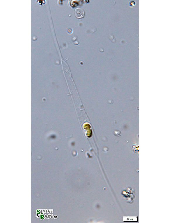 Rhizosolenia longiseta