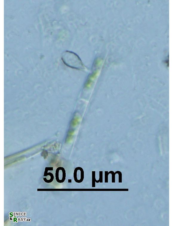 Epipyxis utriculus 