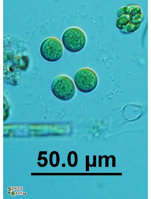 Limnococcus limneticus 