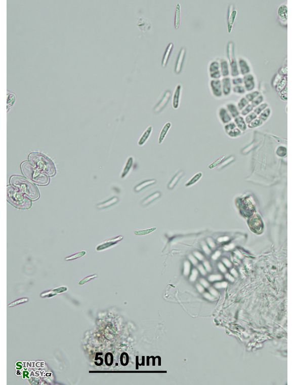 Elakatothrix genevensis