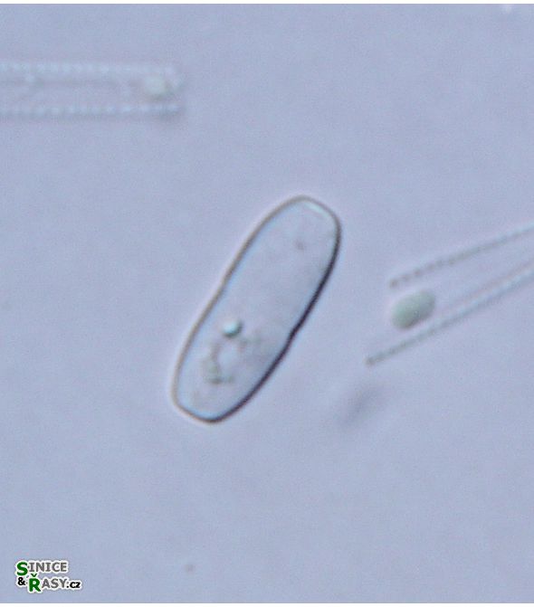 Actinotaenium inconspicuum