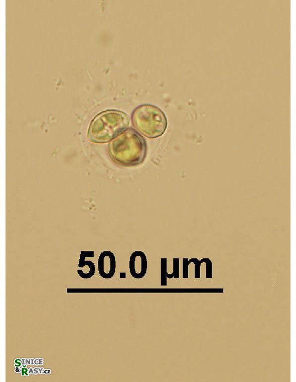 Oocystis cf. marssonii