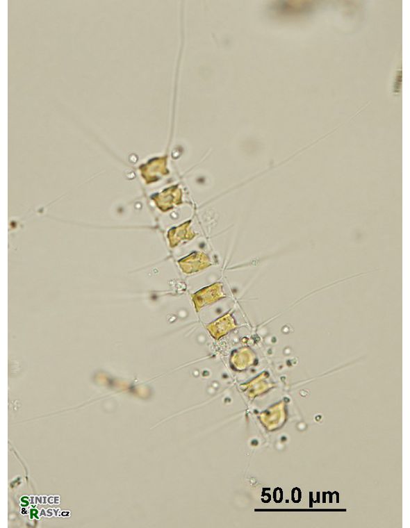 Chaetoceros sp.