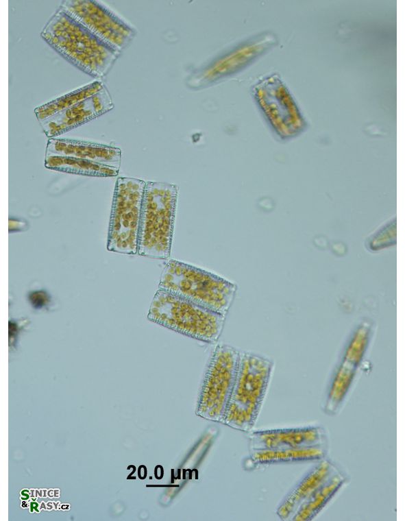 Diatoma vulgaris