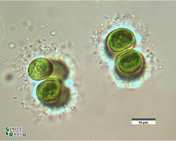 Chroococcus limneticus