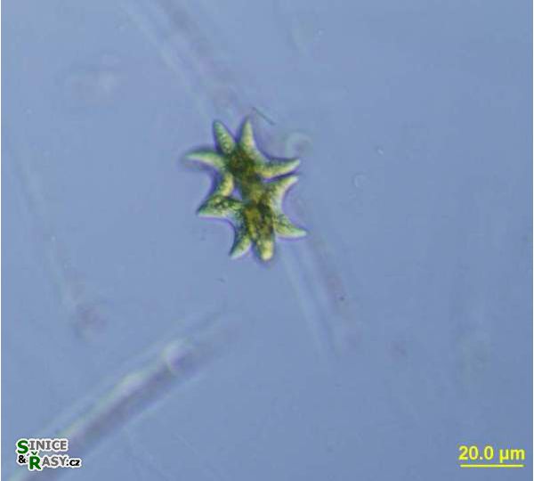 Selenastrum bibraianum
