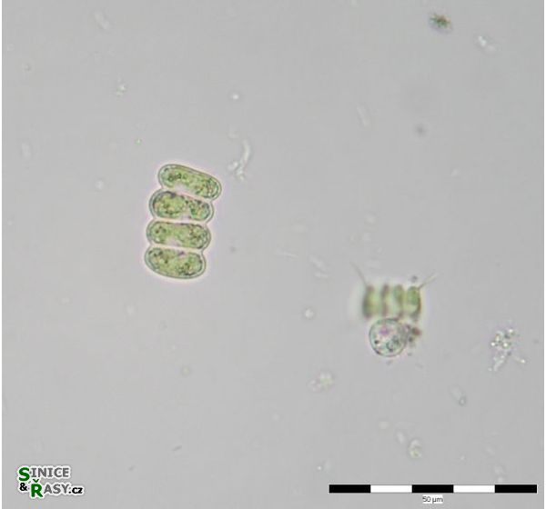 Scenedesmus ellipticus