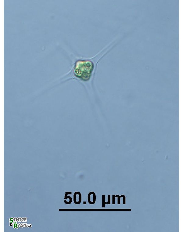 Treubaria schmidlei
