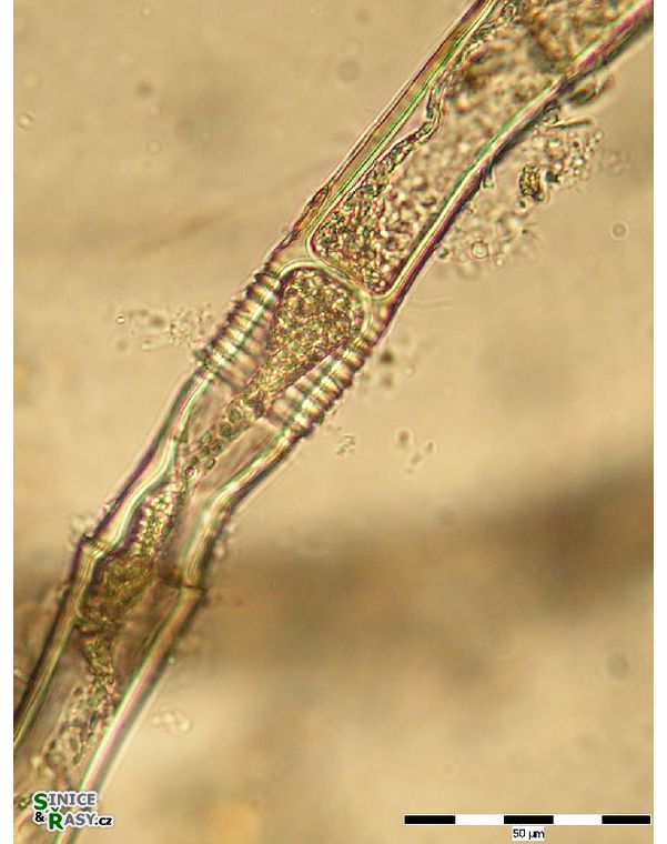 Oedogonium sp.