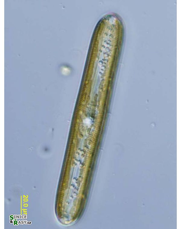 Pinnularia