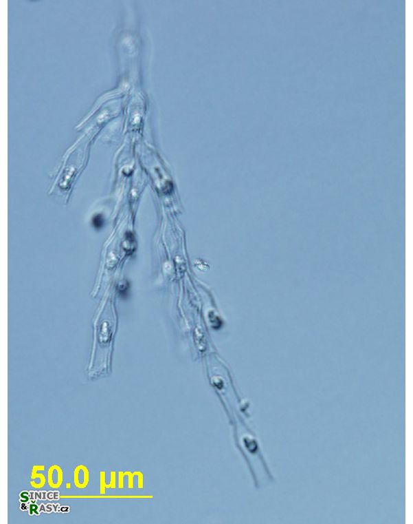Dinobryon divergens