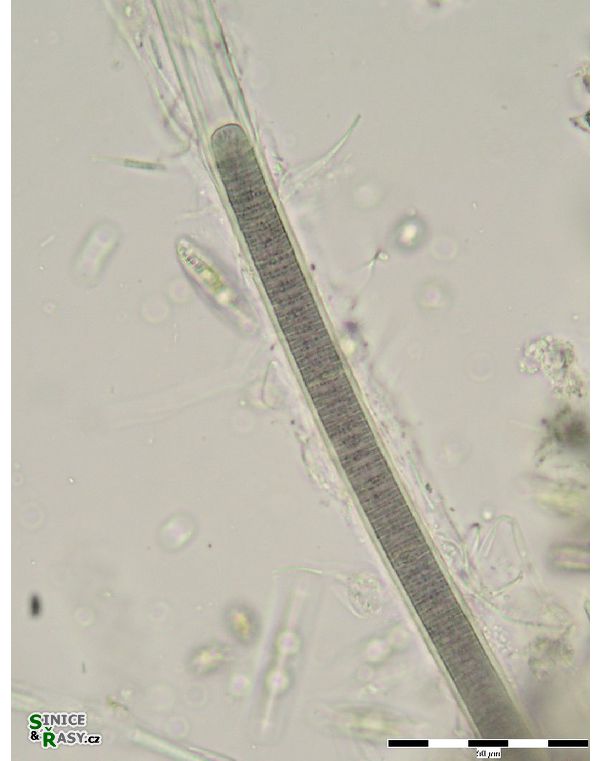 Lyngbya sp. 