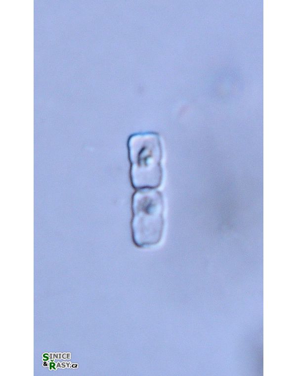 Actinotaenium geniculatum