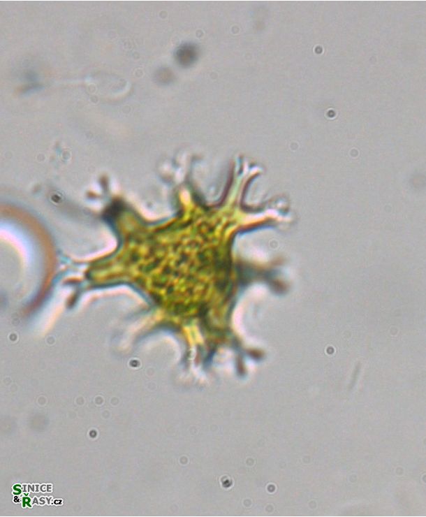 Pseudostaurastrum enorme