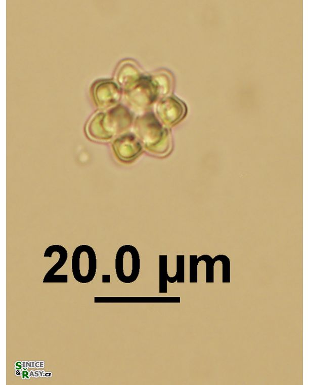 Coelastrum pseudomicroporum