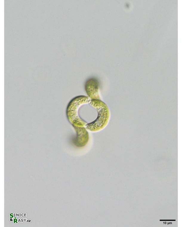 Tetrallanthos lagerheimii