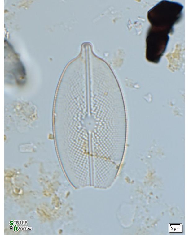 Decussiphycus placenta