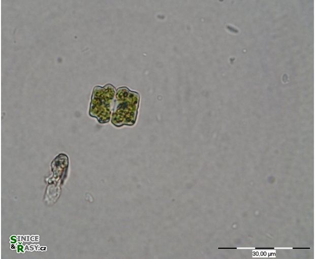 Cosmarium trilobulatum