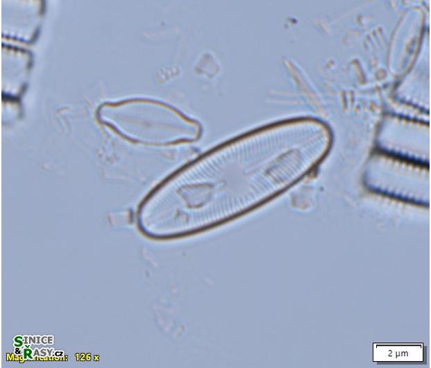 Cavinula variostriata