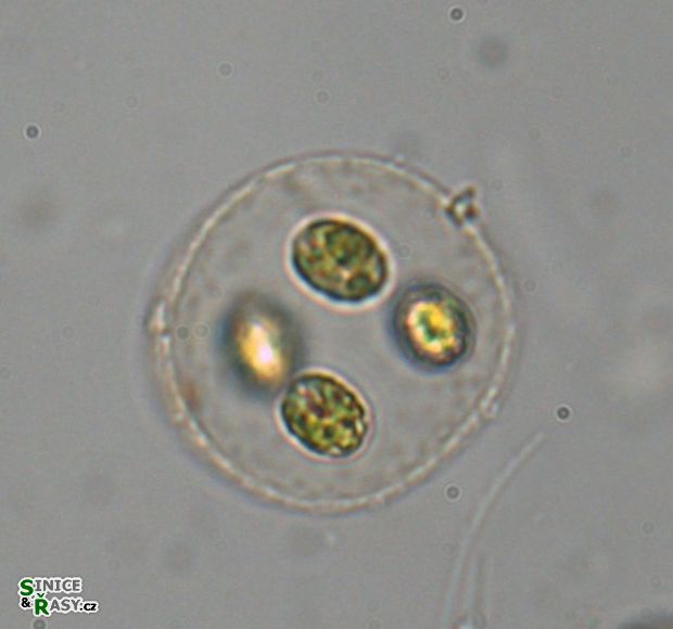 Quadricoccus verrucosus