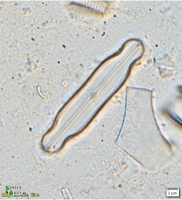 Neidium longiceps