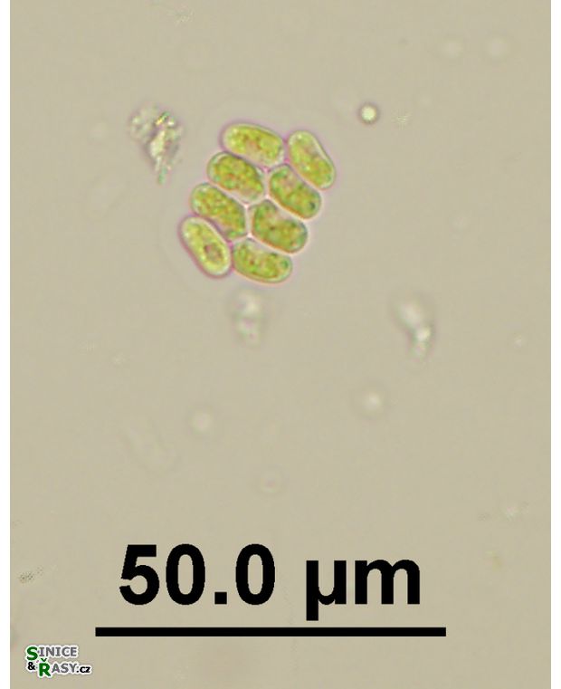 Scenedesmus obtusus var. disciformis