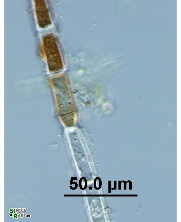 Oedogonium sp. 
