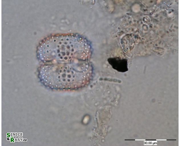 Cosmarium pseudoornatum