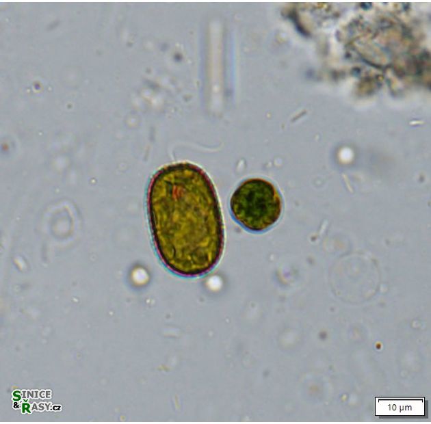 Trachelomonas abrupta