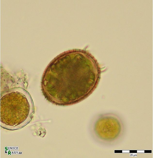 Trachelomonas armata