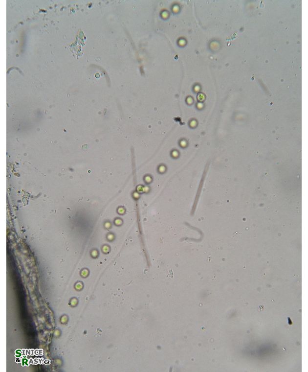 Palmodictyon viride