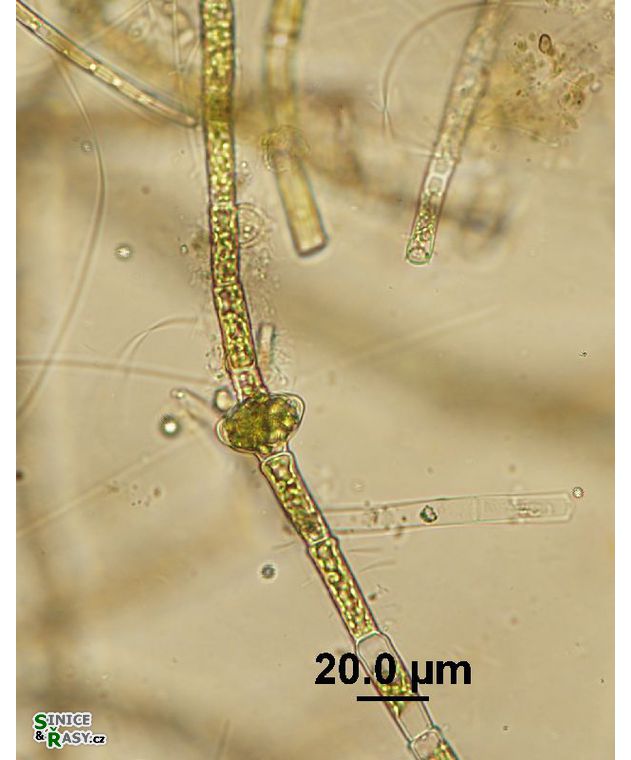 Oedogonium sp.