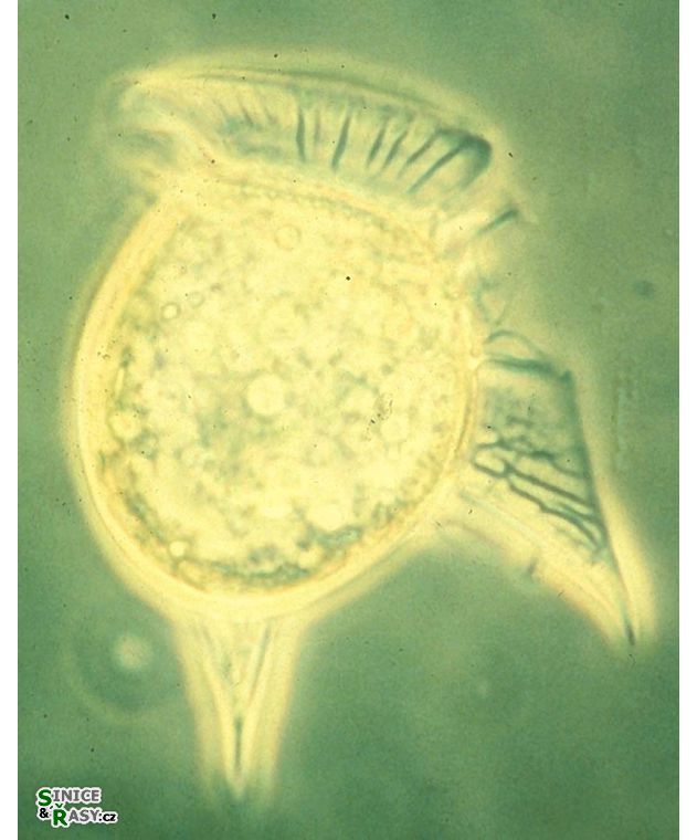 Dinophysis hastata
