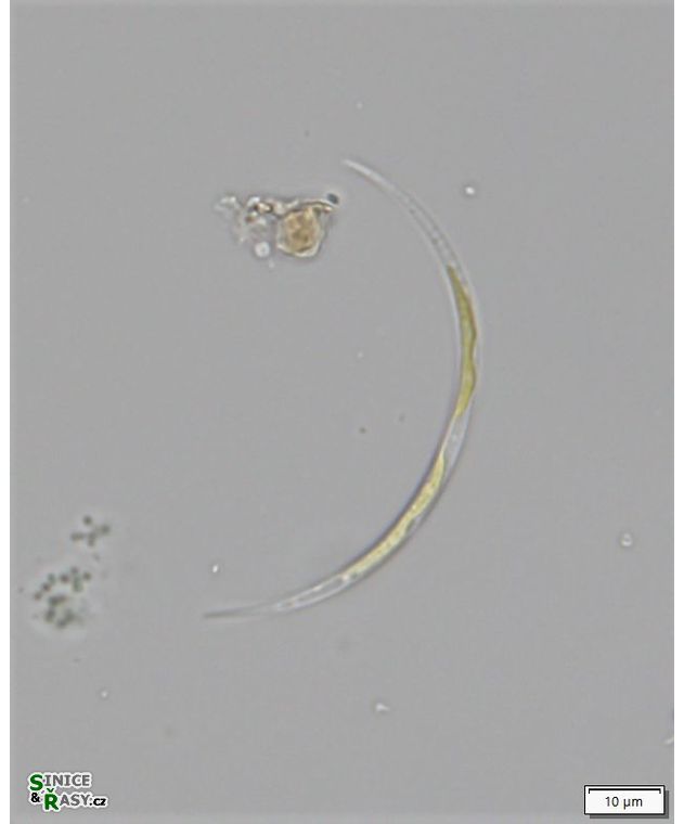 Closterium acutum