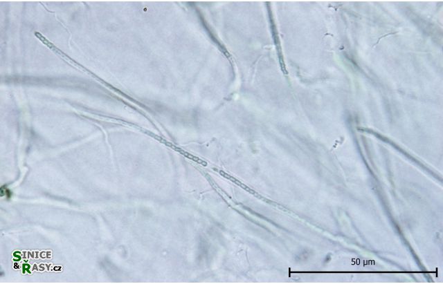 Leptolyngbia