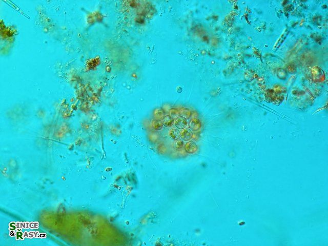 Chrysosphaerella brevispina
