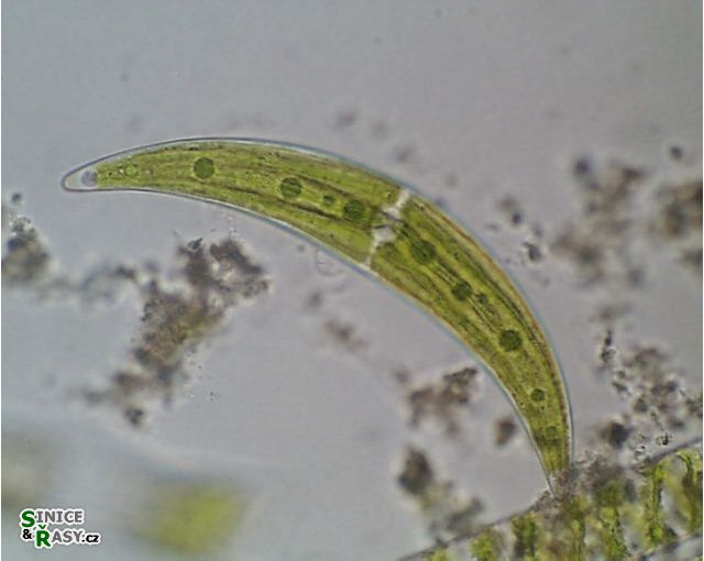 Closterium moniliferum