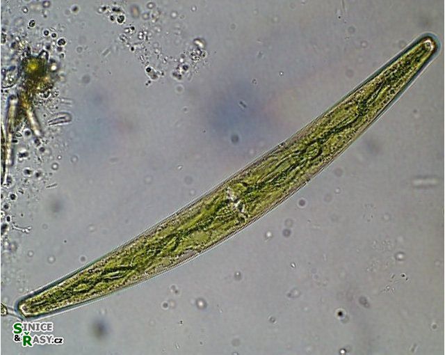 Closterium striolatum