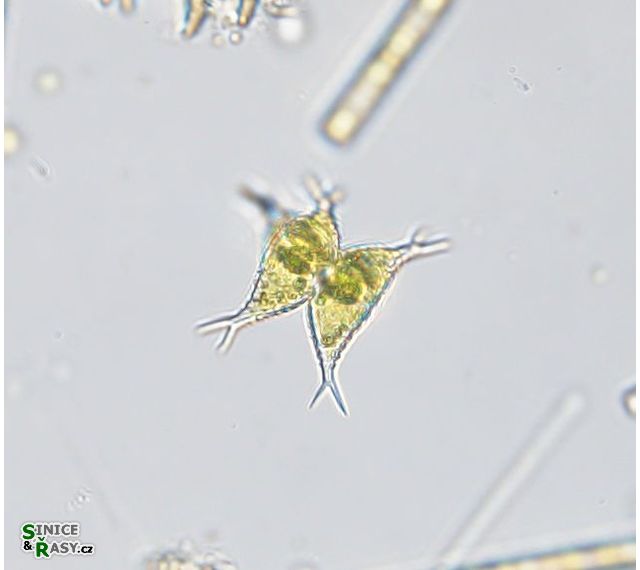 Staurastrum subcruciatum
