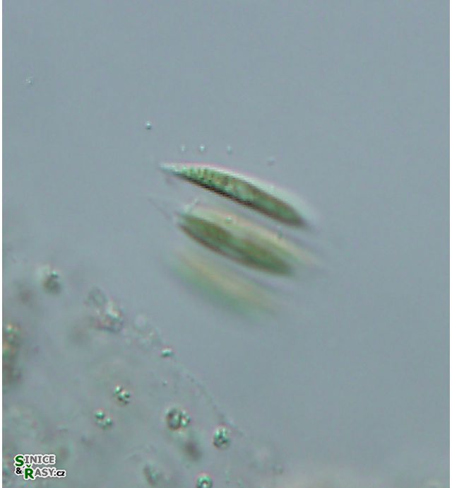 Quadrigula closterioides