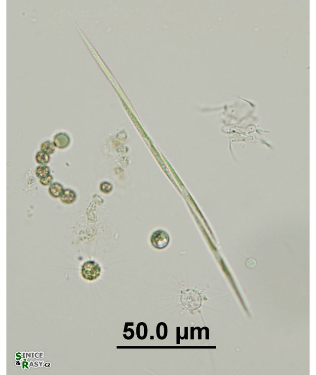 Monoraphidium komarkovae