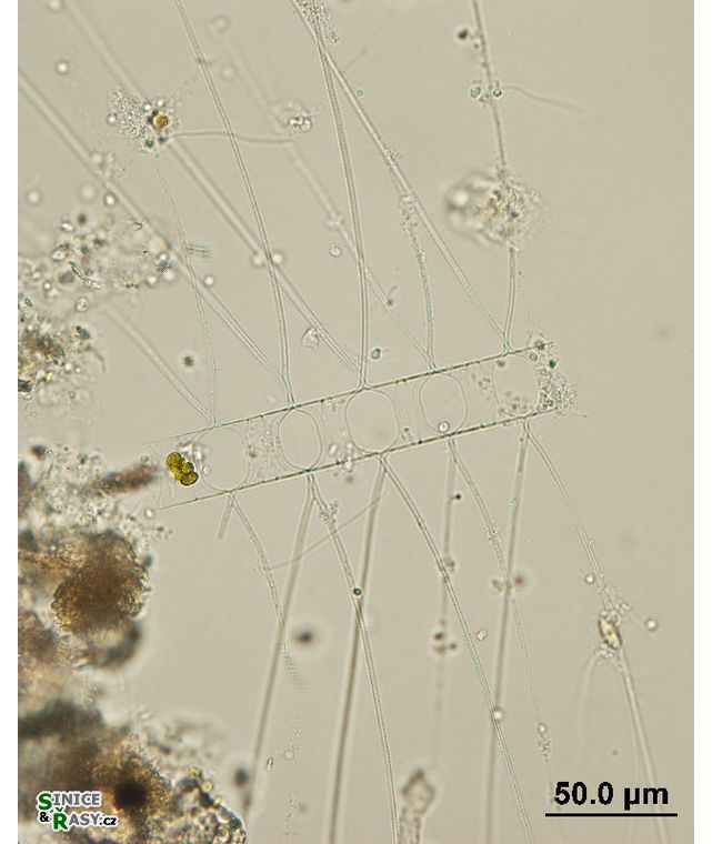 Chaetoceros sp. 